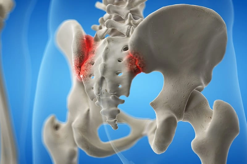 Sacroiliac Image