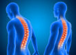 Spinal stenosis treatment