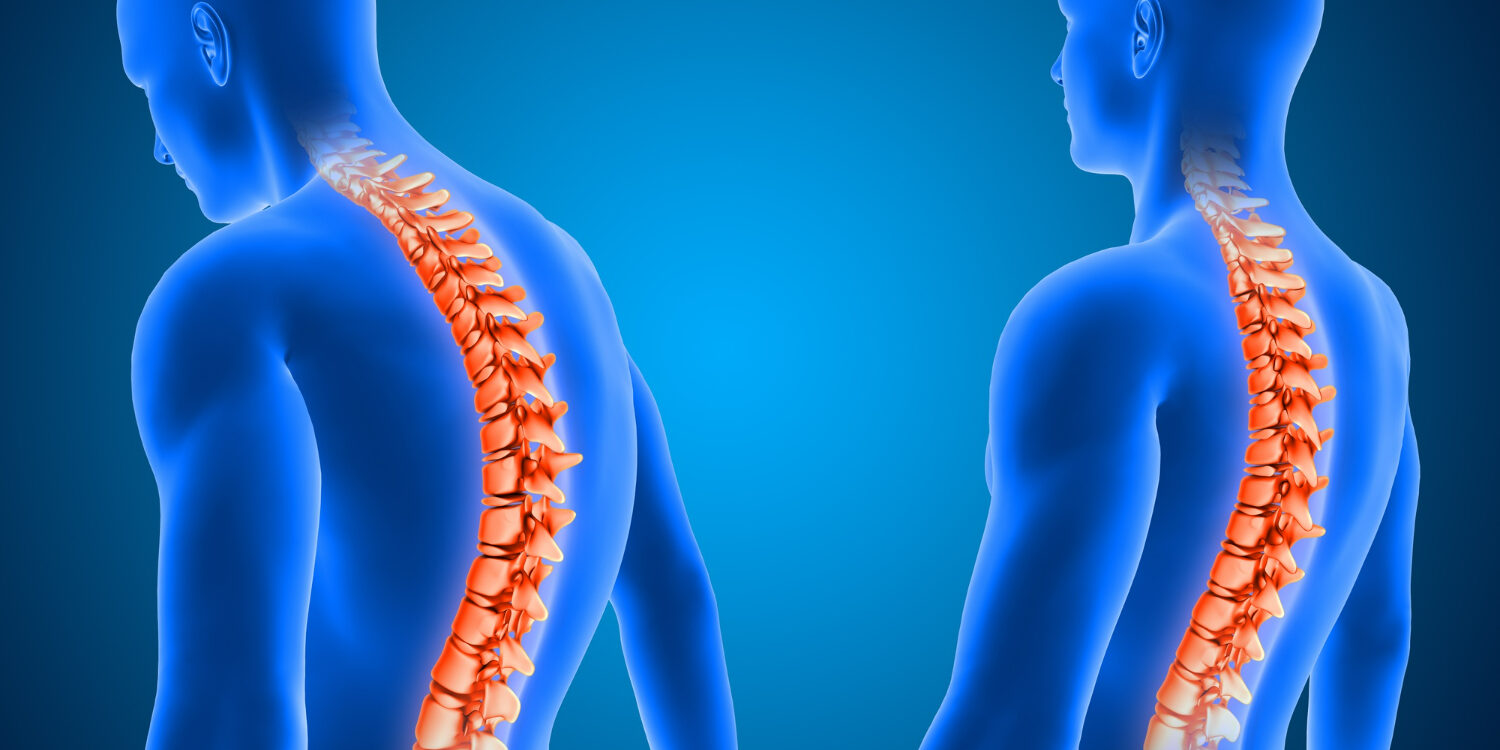 Spinal stenosis treatment